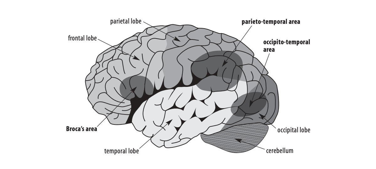 Annotated diagram of the reading areas of the brain